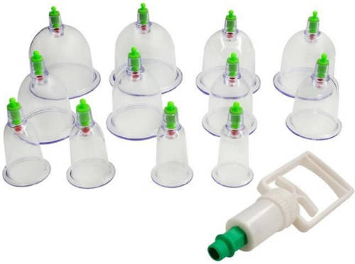 Iso Trade 20-Delige Cupping set met 6 formaten cups - Pull out vacuum apparaat