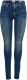 Only high waist skinny jeans blauw